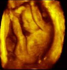 Ultrasound image